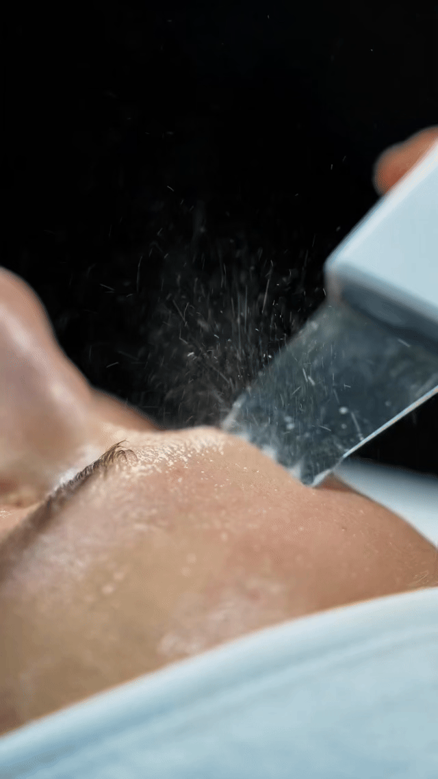 Dispositivo Ultrasónico de Limpieza Facial – Rutina Profesional