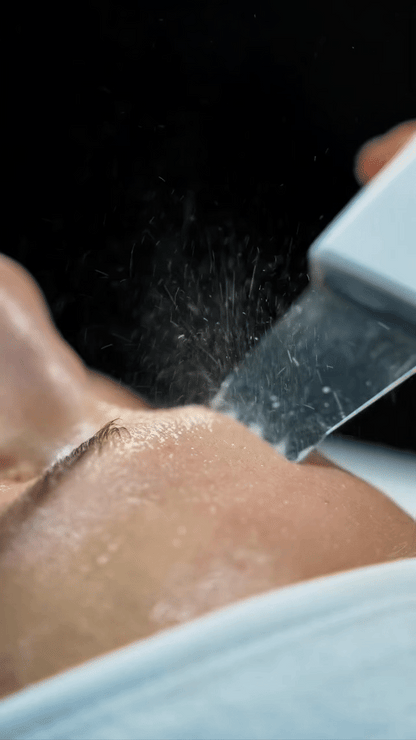 Dispositivo Ultrasónico de Limpieza Facial – Rutina Profesional