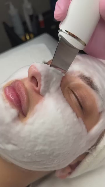 Dispositivo Ultrasónico de Limpieza Facial – Rutina Profesional